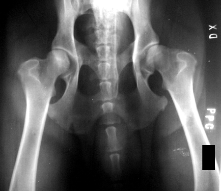 clicuri și dureri în articulațiile genunchiului amorteala durerii articulare la sold